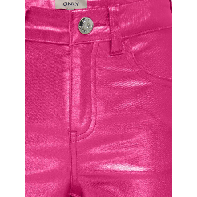 Only Kogjuicy wide metal coated neon 2109.65.0006 large