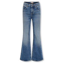 Only Jeans 15327051 kogjuicy